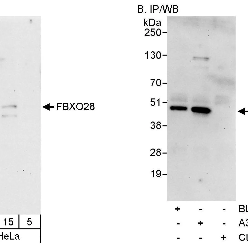 Rabbit anti-FBXO28 Antibody, Affinity Purified