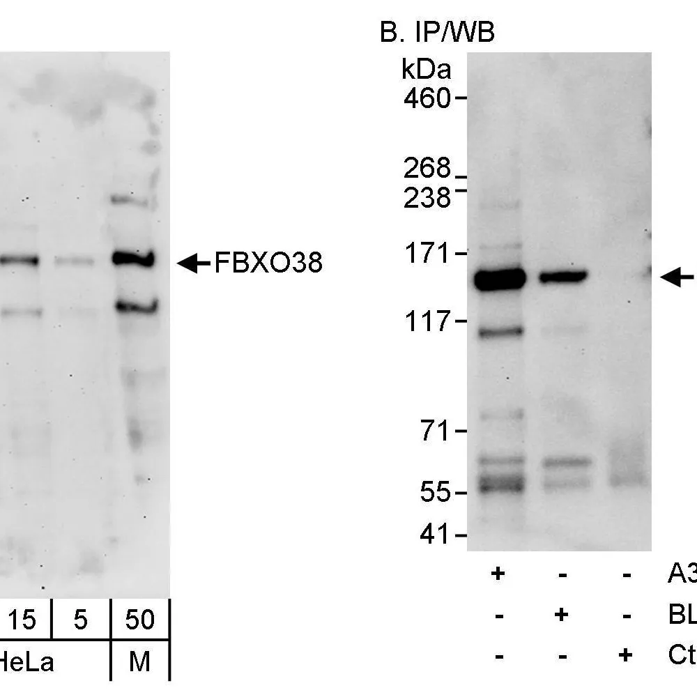 Rabbit anti-FBXO38 Antibody, Affinity Purified