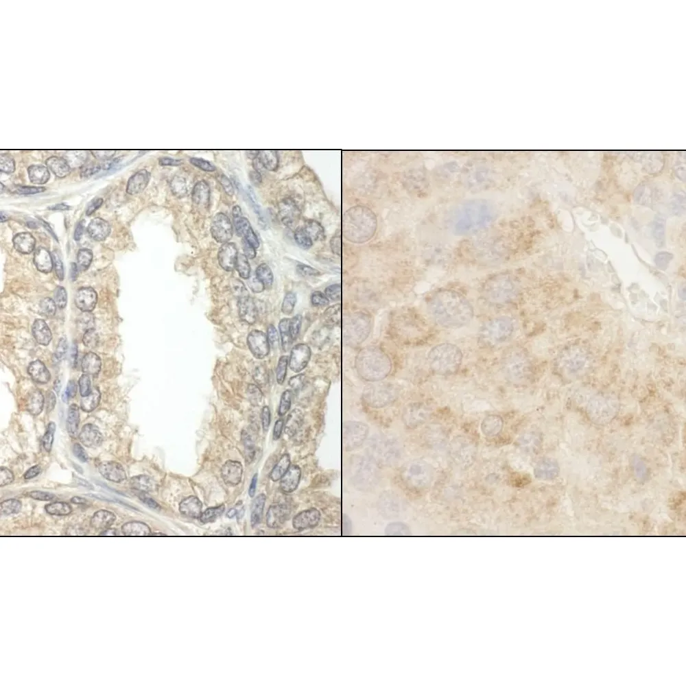 Rabbit anti-BAD Antibody, Affinity Purified