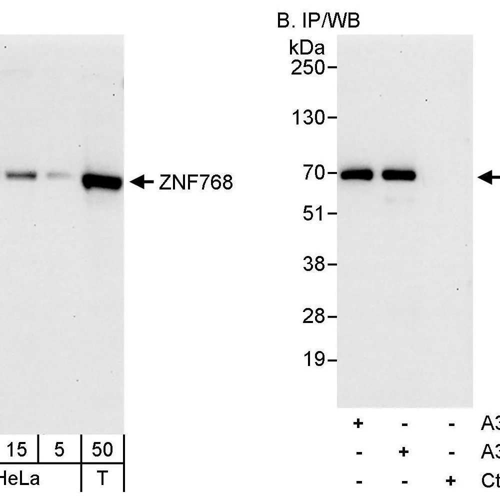 Rabbit anti-ZNF768 Antibody, Affinity Purified