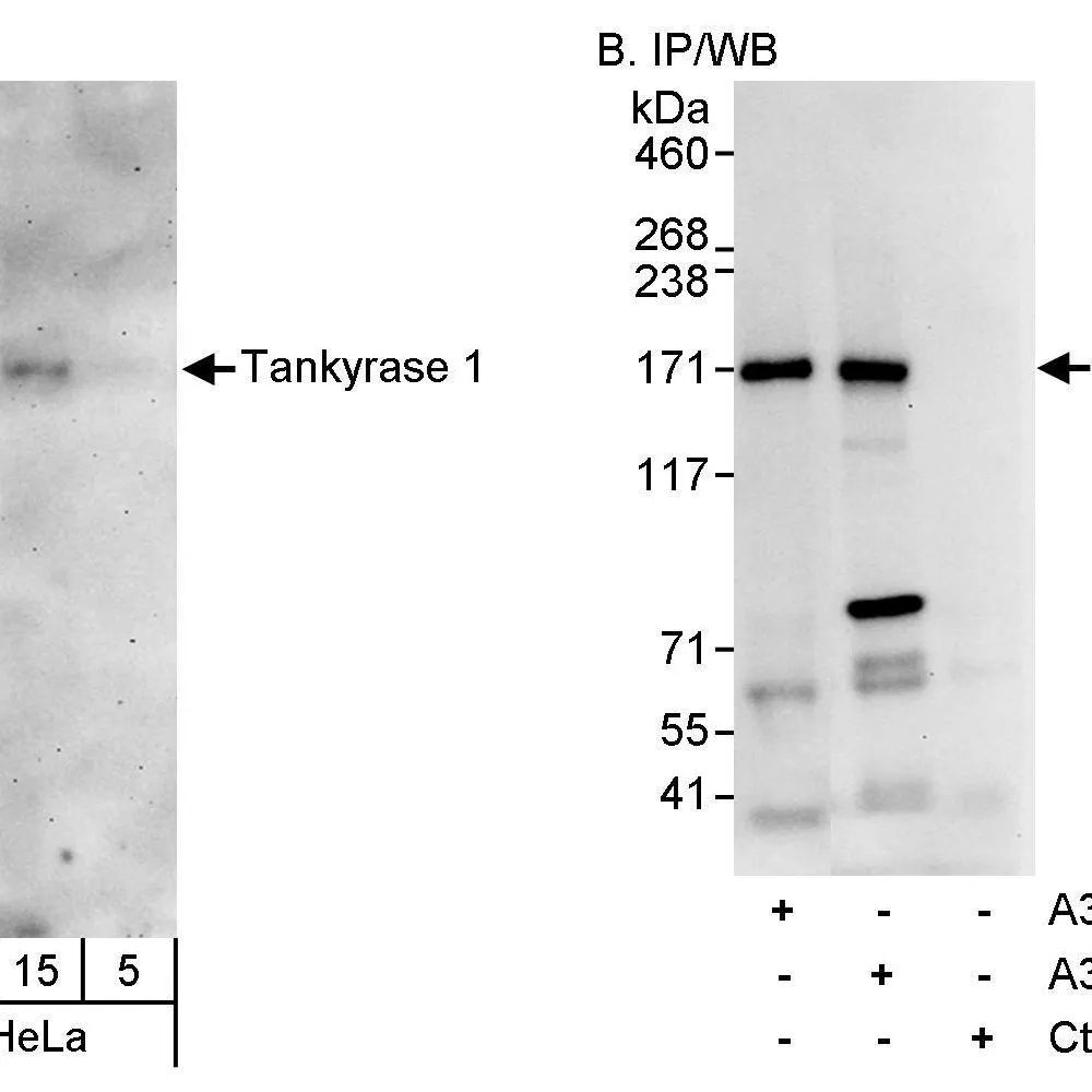 Rabbit anti-Tankyrase 1 Antibody, Affinity Purified