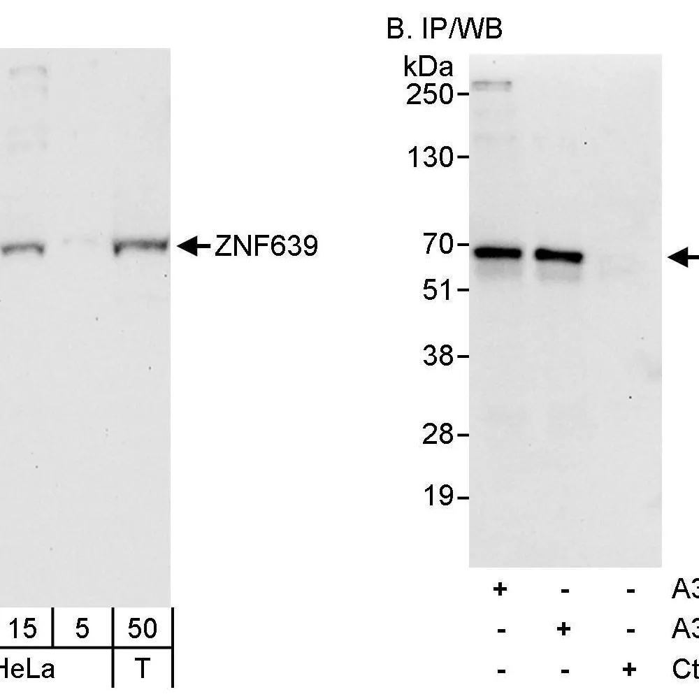 Rabbit anti-ZNF639 Antibody, Affinity Purified