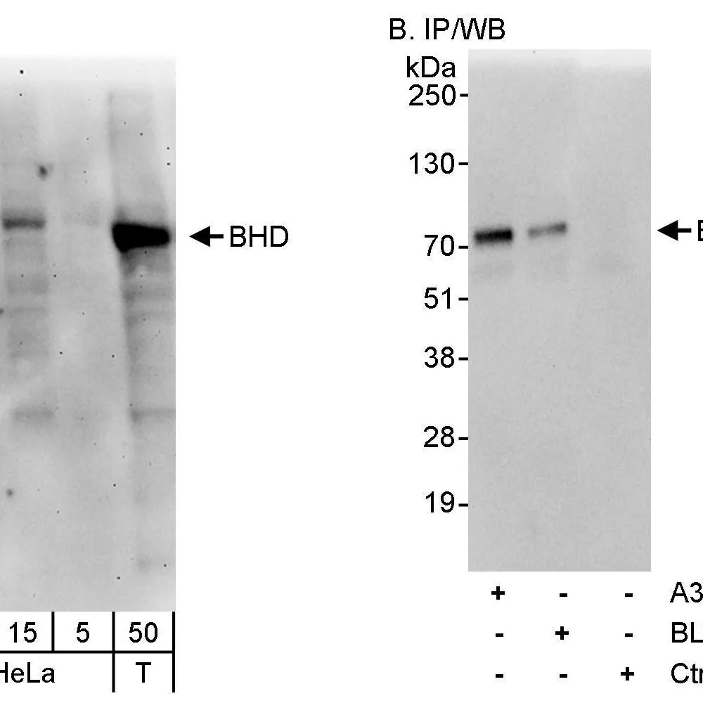 Rabbit anti-BHD Antibody, Affinity Purified