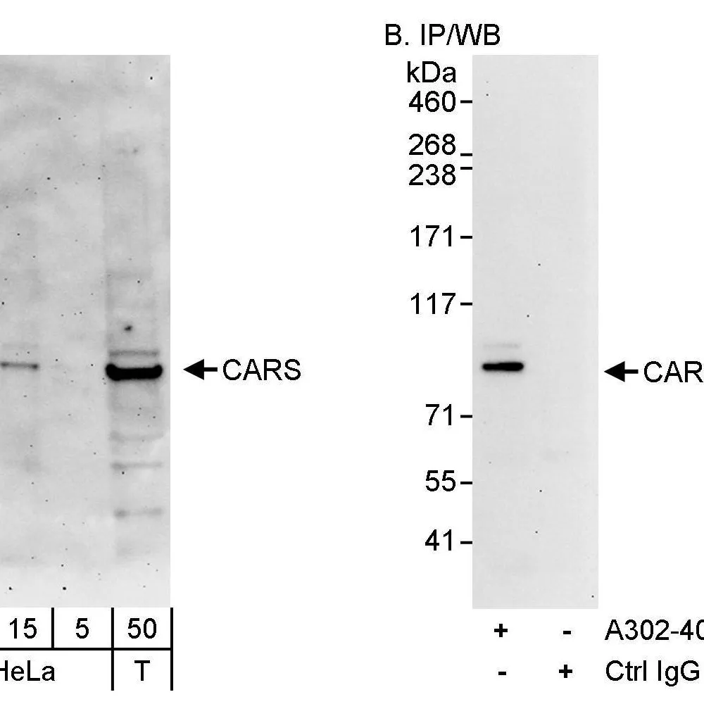 Rabbit anti-CARS Antibody, Affinity Purified