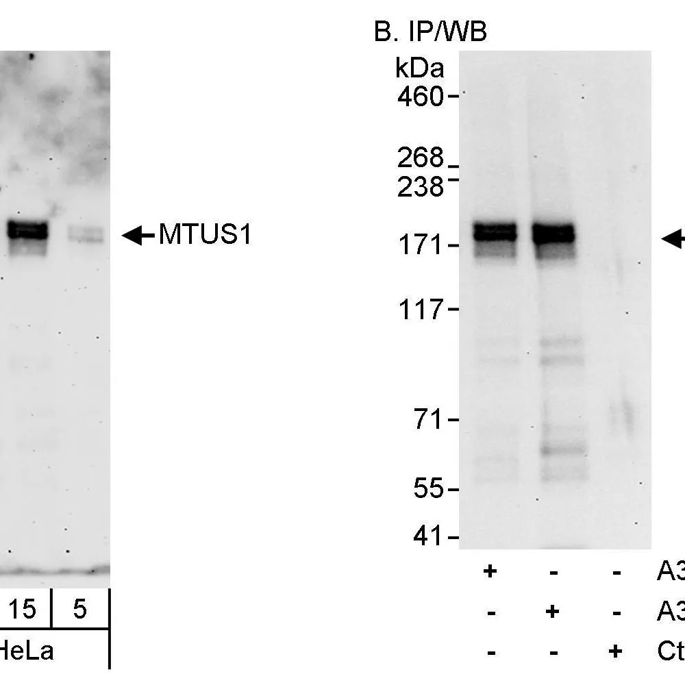 Rabbit anti-MTUS1 Antibody, Affinity Purified