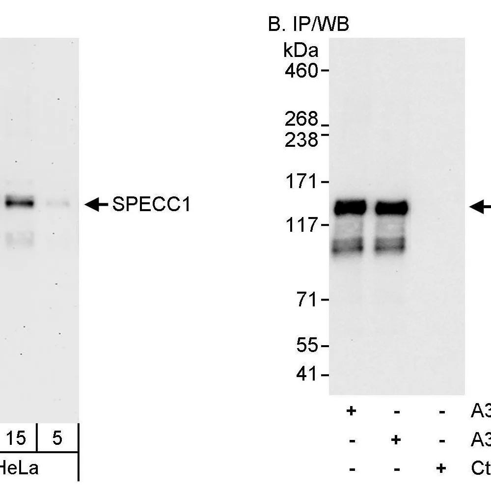 Rabbit anti-SPECC1 Antibody, Affinity Purified