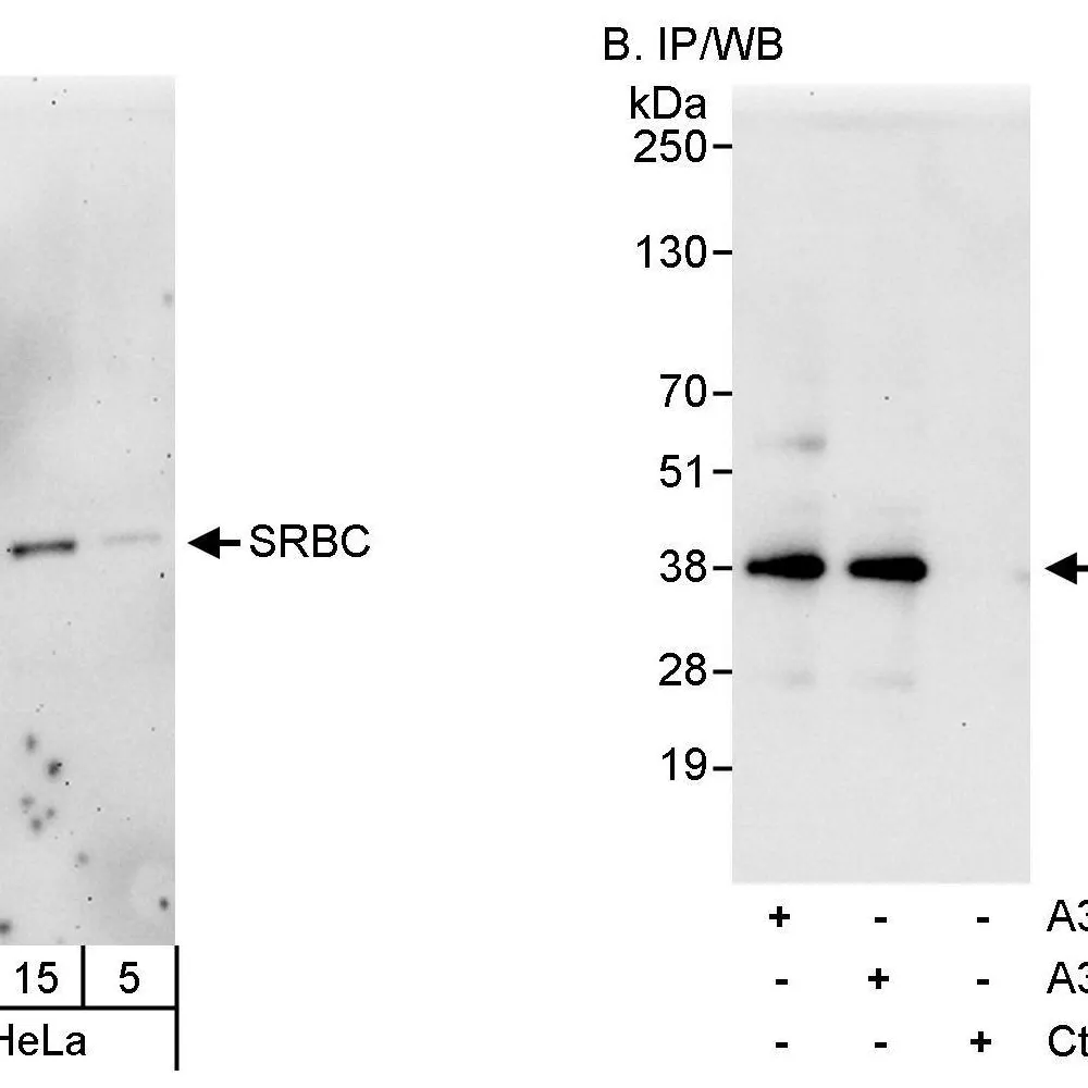 Rabbit anti-SRBC Antibody, Affinity Purified