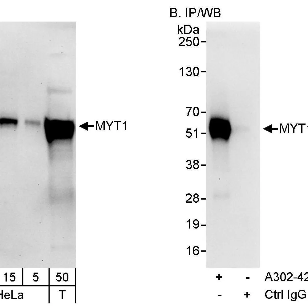 Rabbit anti-MYT1 Antibody, Affinity Purified