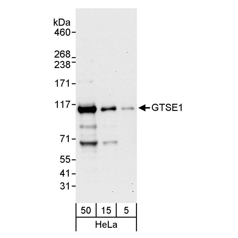Rabbit anti-GTSE1 Antibody, Affinity Purified
