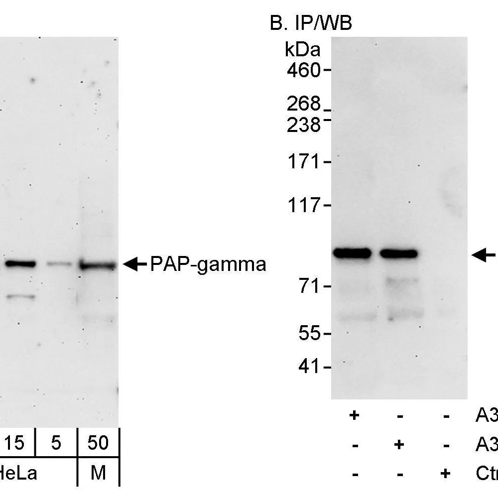 Rabbit anti-PAP-gamma Antibody, Affinity Purified