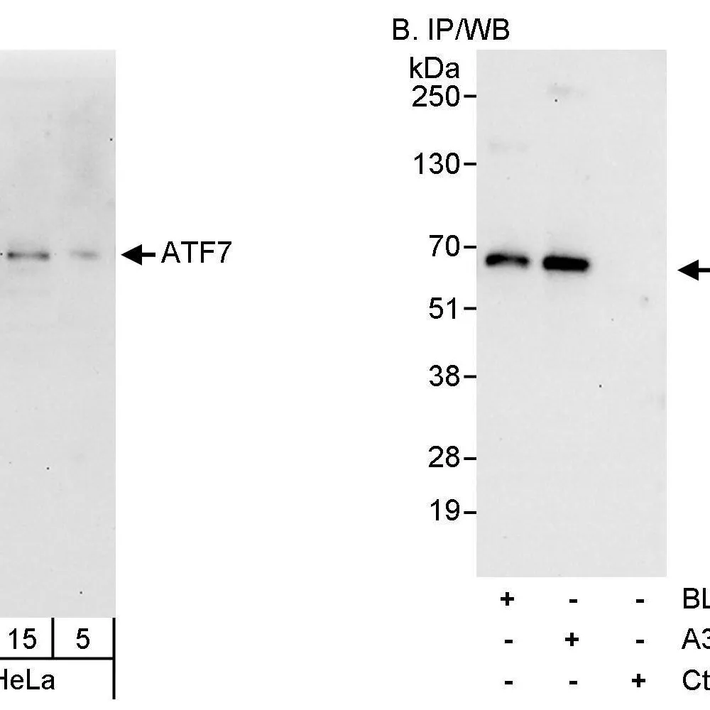 Rabbit anti-ATF7 Antibody, Affinity Purified