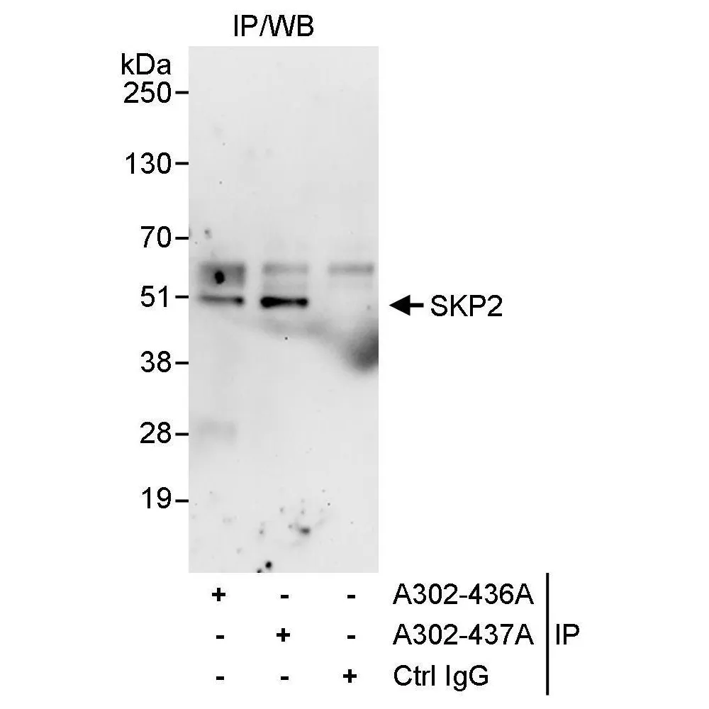 Rabbit anti-SKP2 Antibody, Affinity Purified