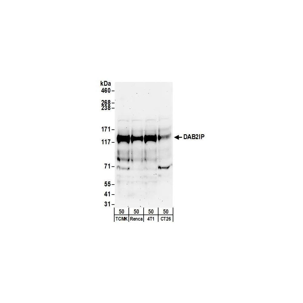 Rabbit anti-DAB2IP Antibody, Affinity Purified