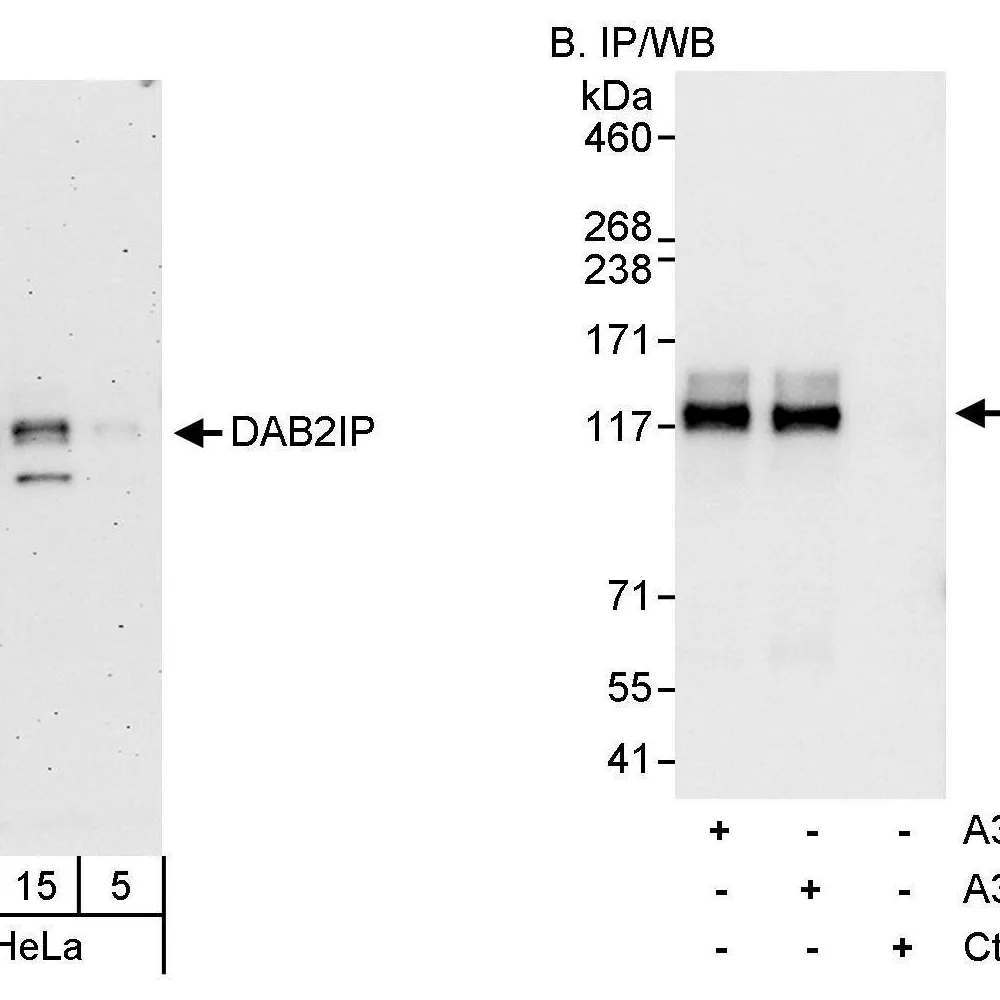 Rabbit anti-DAB2IP Antibody, Affinity Purified