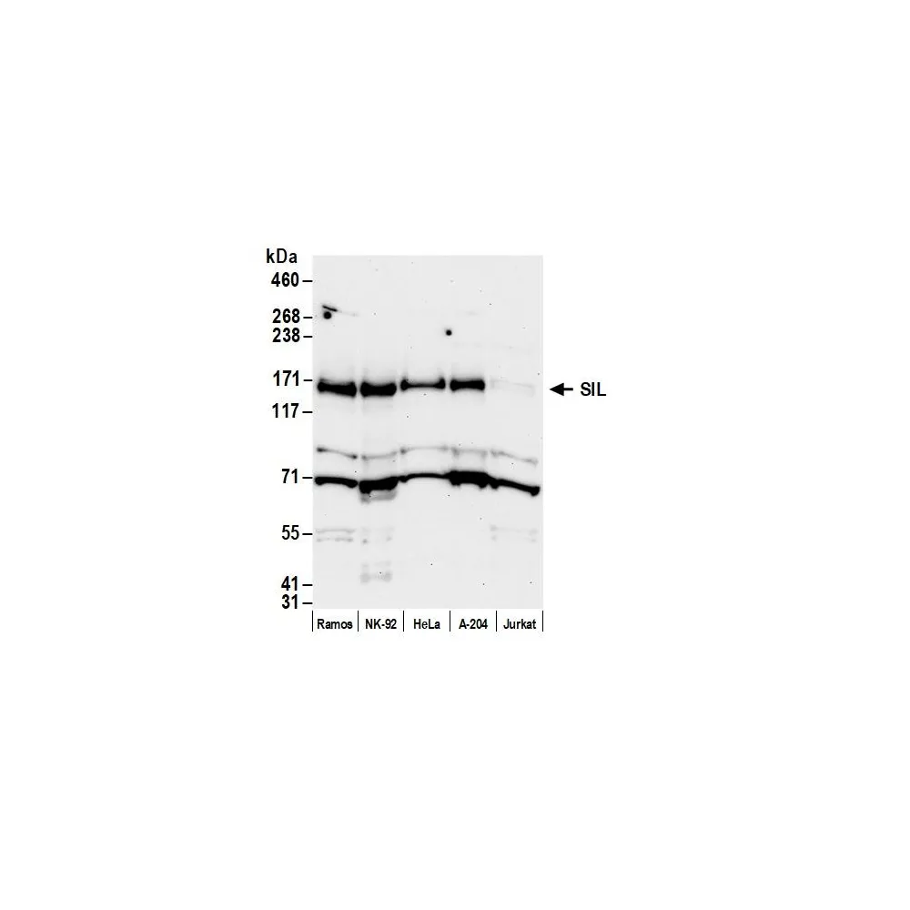 Rabbit anti-SIL Antibody, Affinity Purified