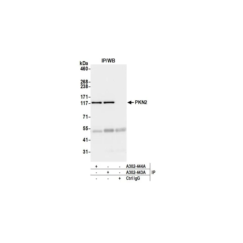 Rabbit anti-PKN2 Antibody, Affinity Purified