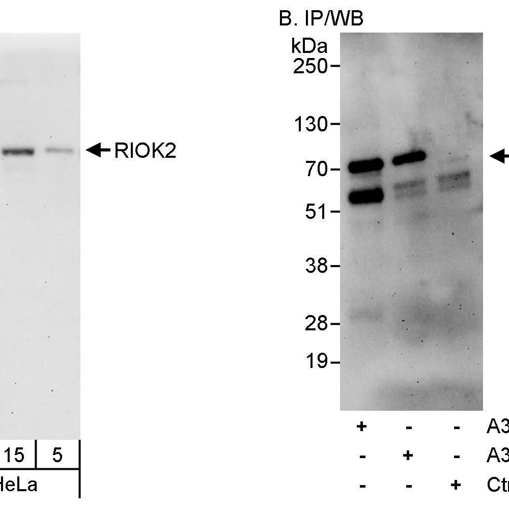 Rabbit anti-RIOK2 Antibody, Affinity Purified