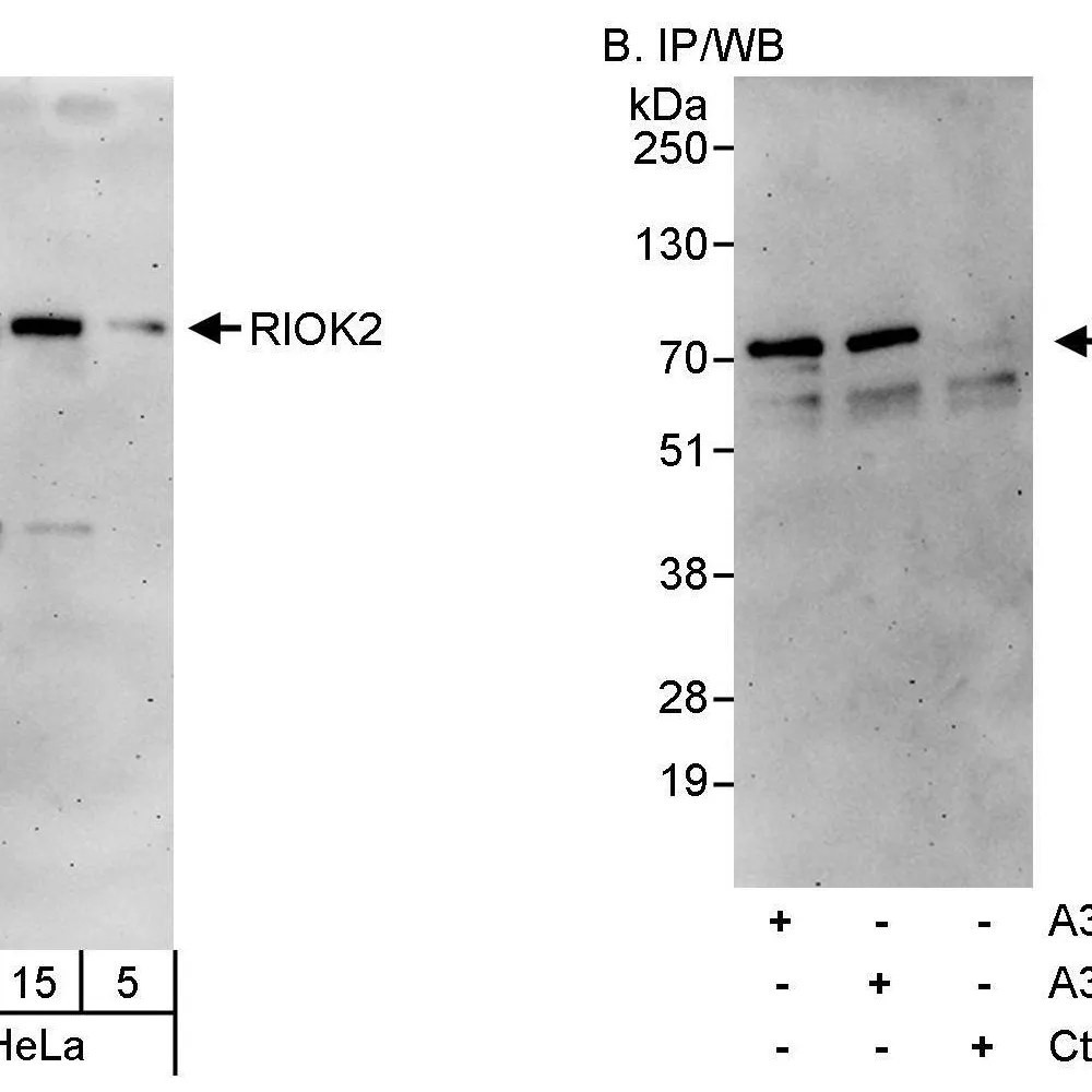 Rabbit anti-RIOK2 Antibody, Affinity Purified