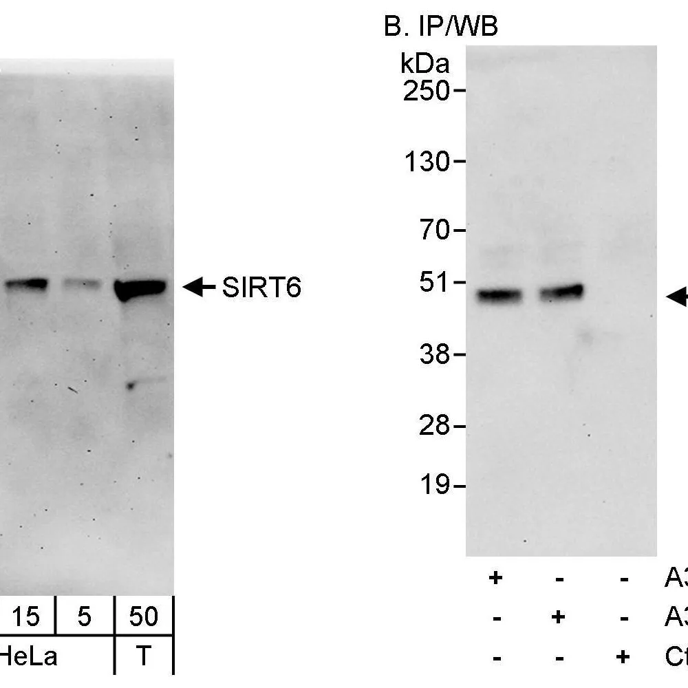 Rabbit anti-Sirt6 Antibody, Affinity Purified