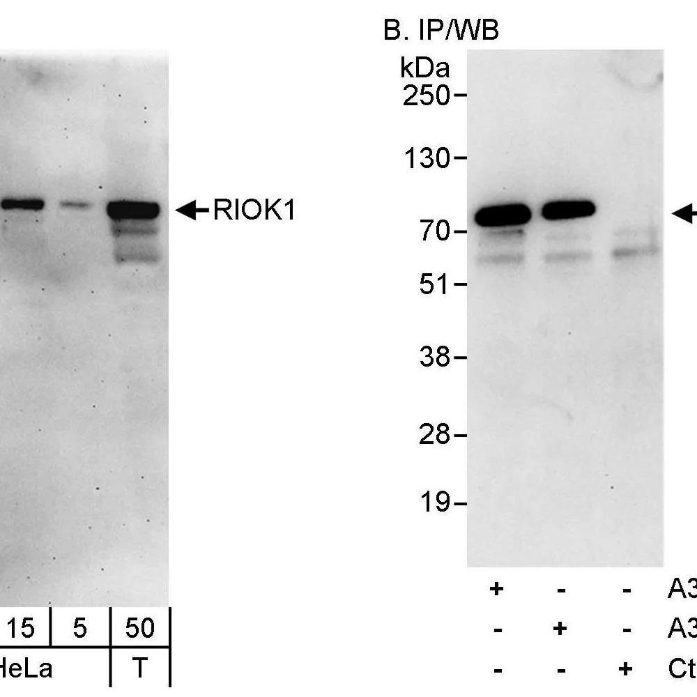 Rabbit anti-RIOK1 Antibody, Affinity Purified