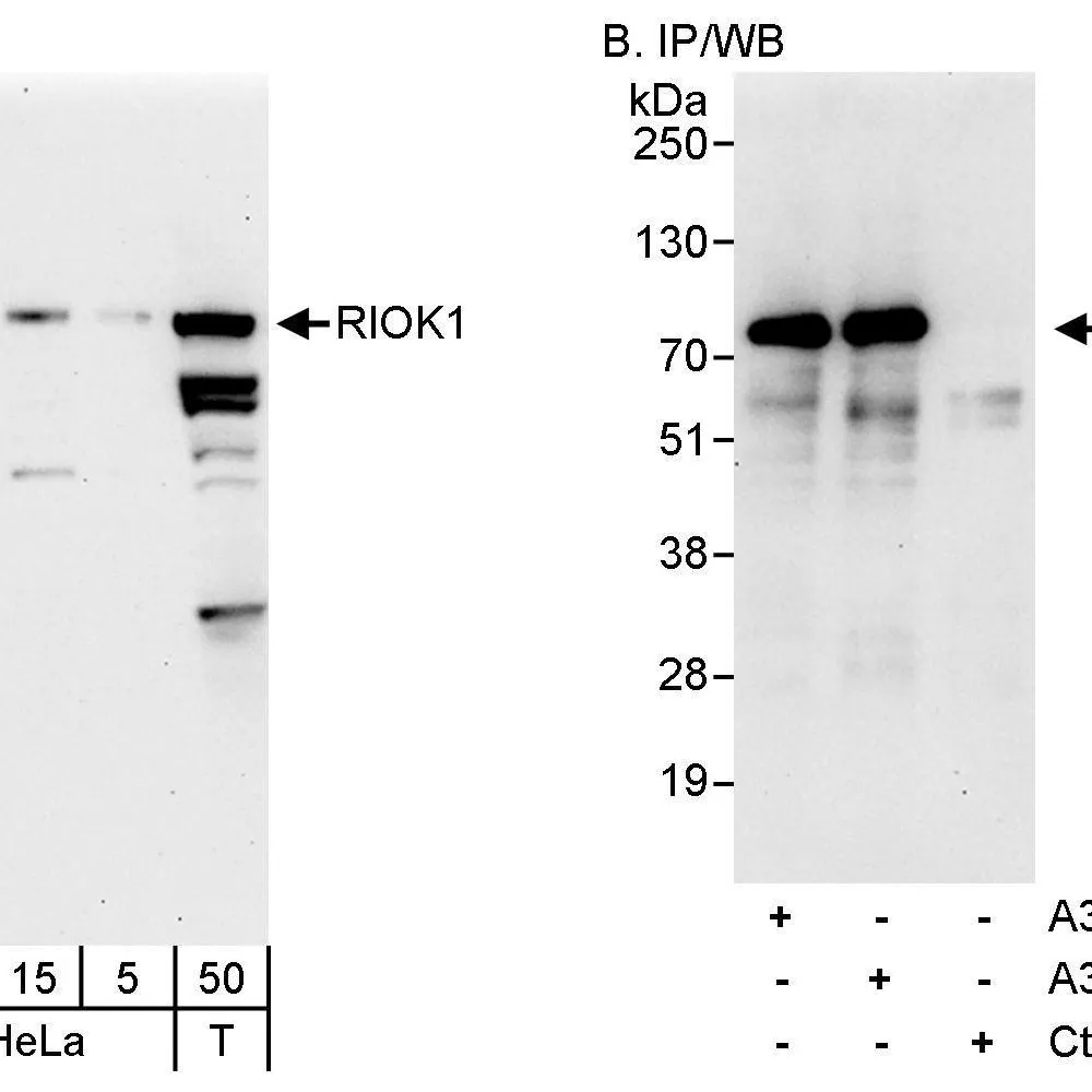 Rabbit anti-RIOK1 Antibody, Affinity Purified