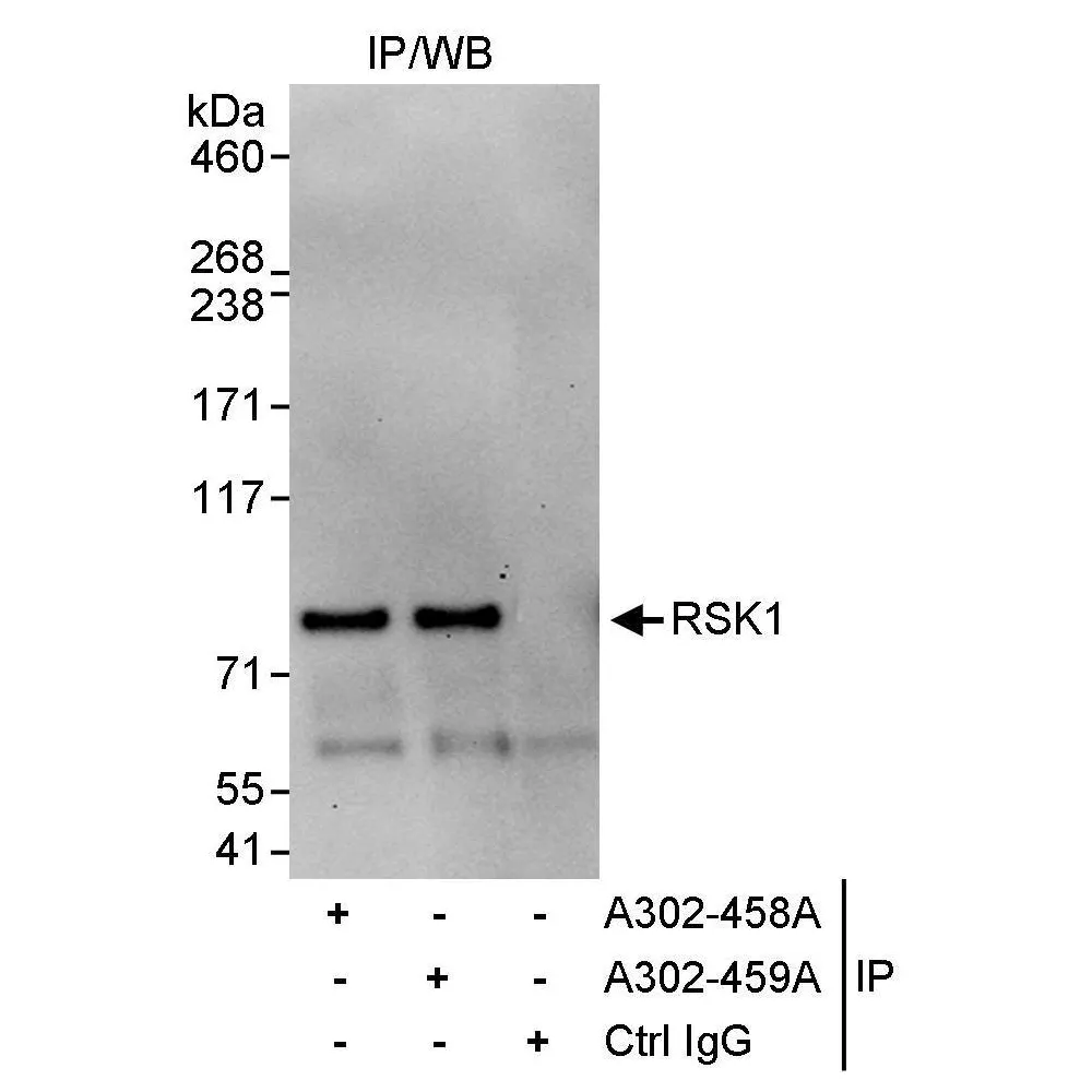 Rabbit anti-RSK1 Antibody, Affinity Purified