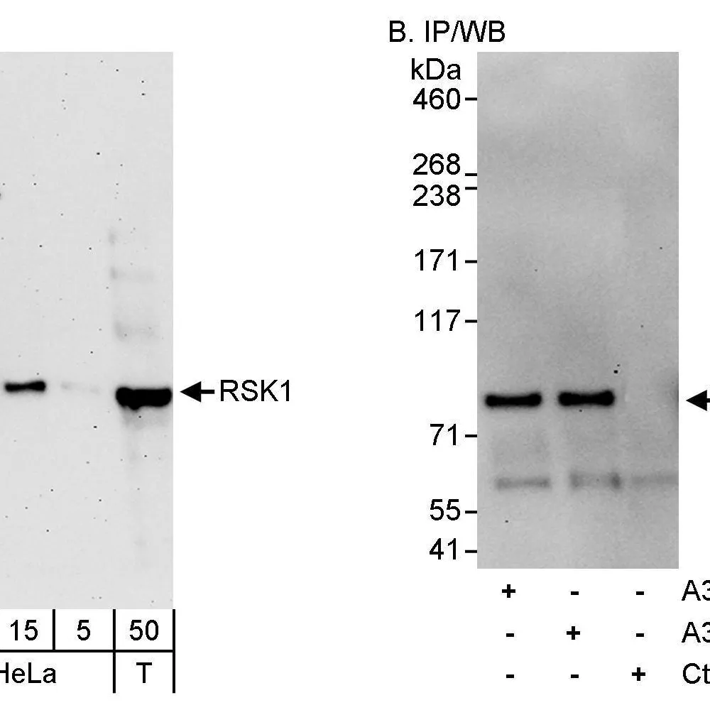 Rabbit anti-RSK1 Antibody, Affinity Purified