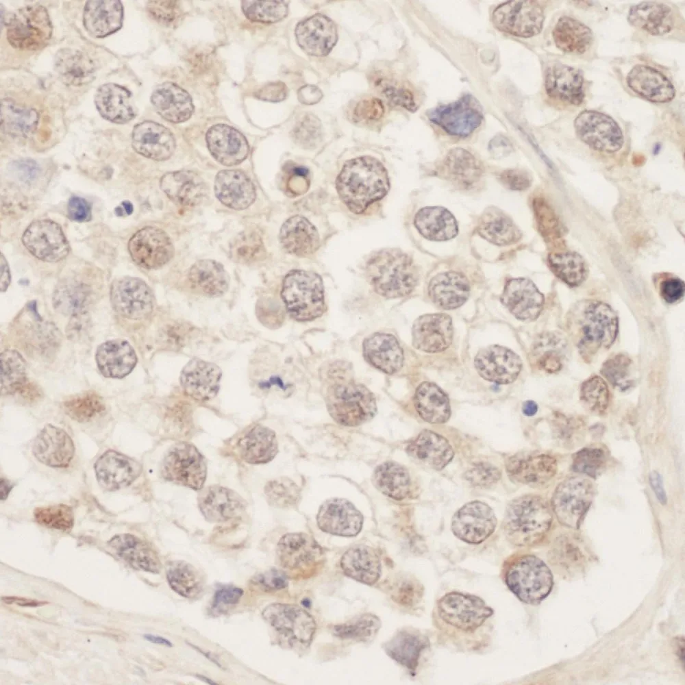 Rabbit anti-SRPK1 Antibody, Affinity Purified