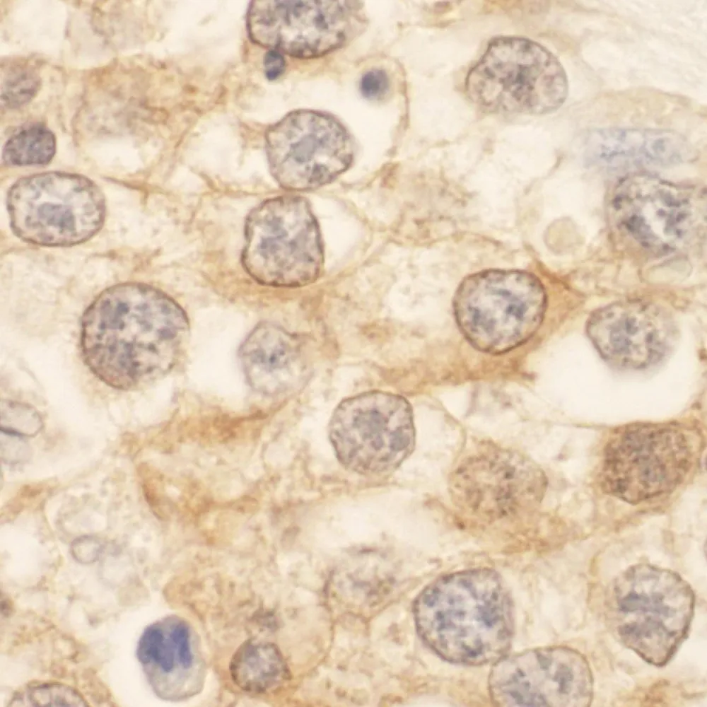 Rabbit anti-SPAK Antibody, Affinity Purified
