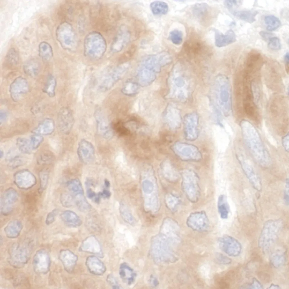 Rabbit anti-SRPK2 Antibody, Affinity Purified