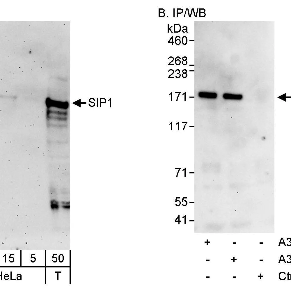 Rabbit anti-ZEB2/SIP Antibody, Affinity Purified
