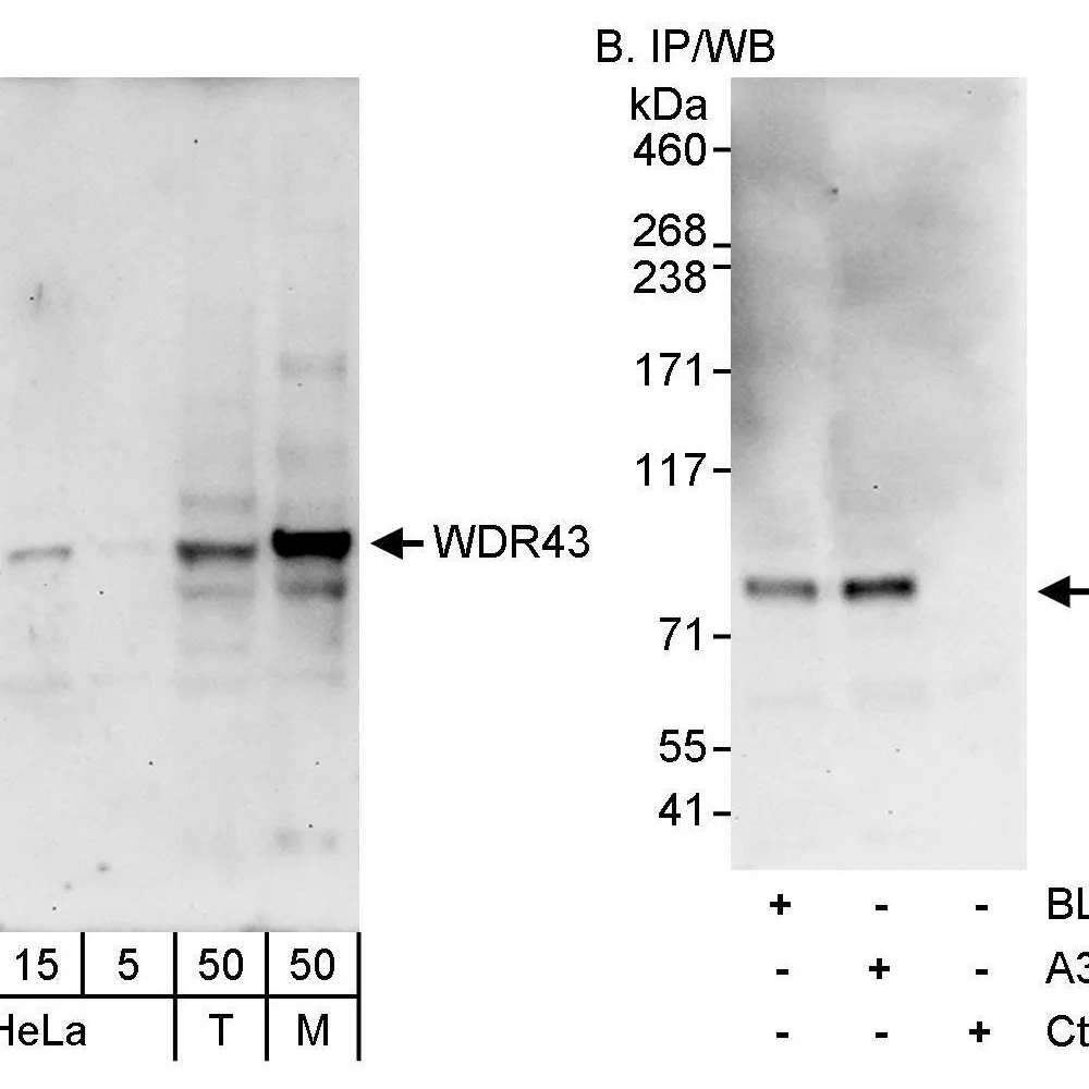 Rabbit anti-WDR43 Antibody, Affinity Purified