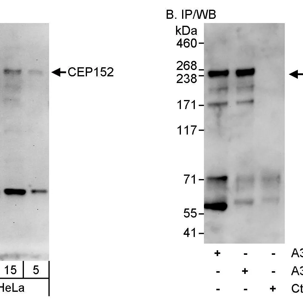 Rabbit anti-CEP152 Antibody, Affinity Purified