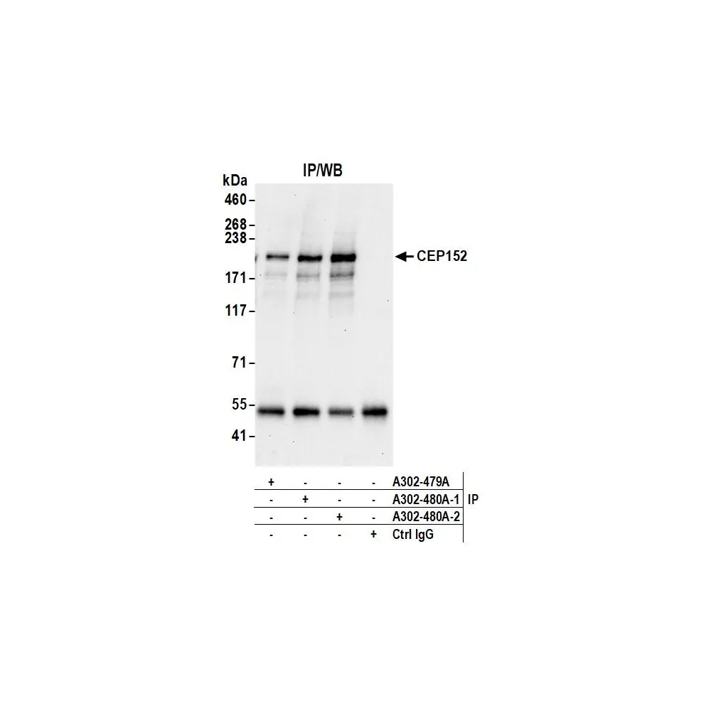 Rabbit anti-CEP152 Antibody, Affinity Purified