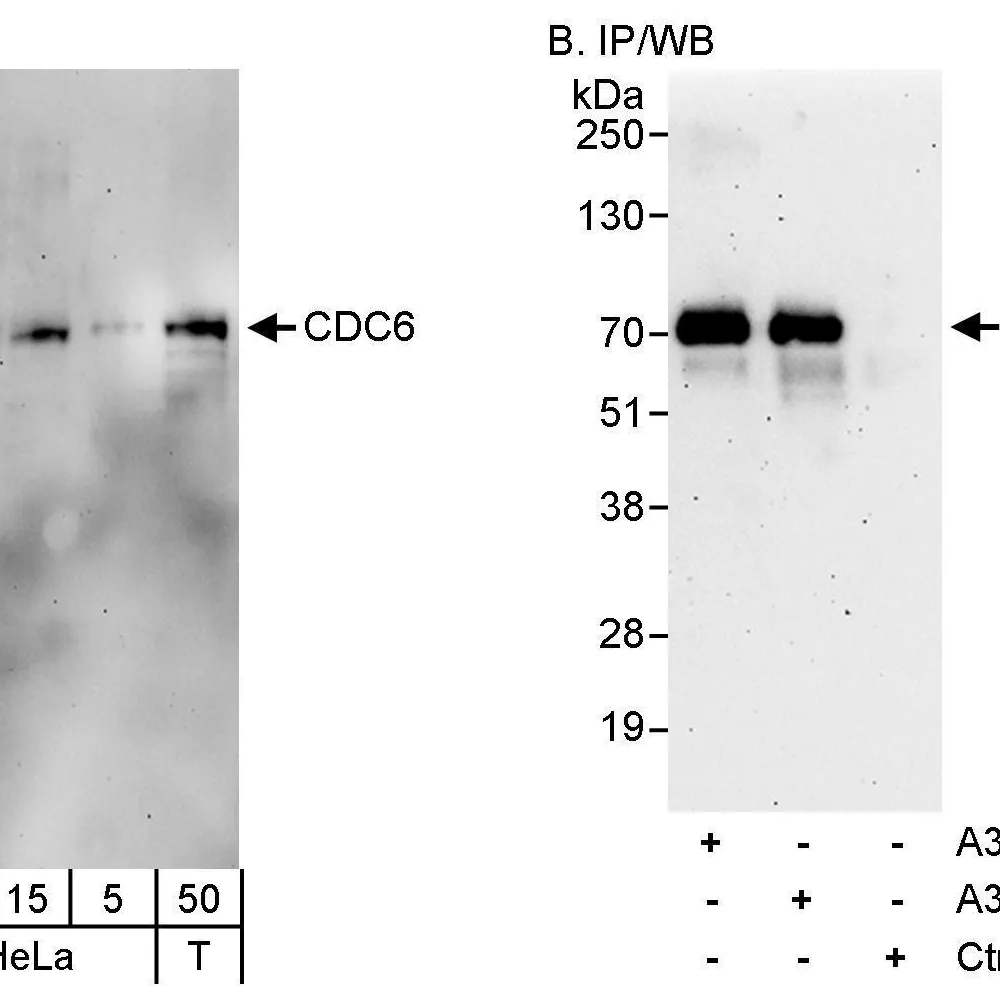 Rabbit anti-CDC6 Antibody, Affinity Purified