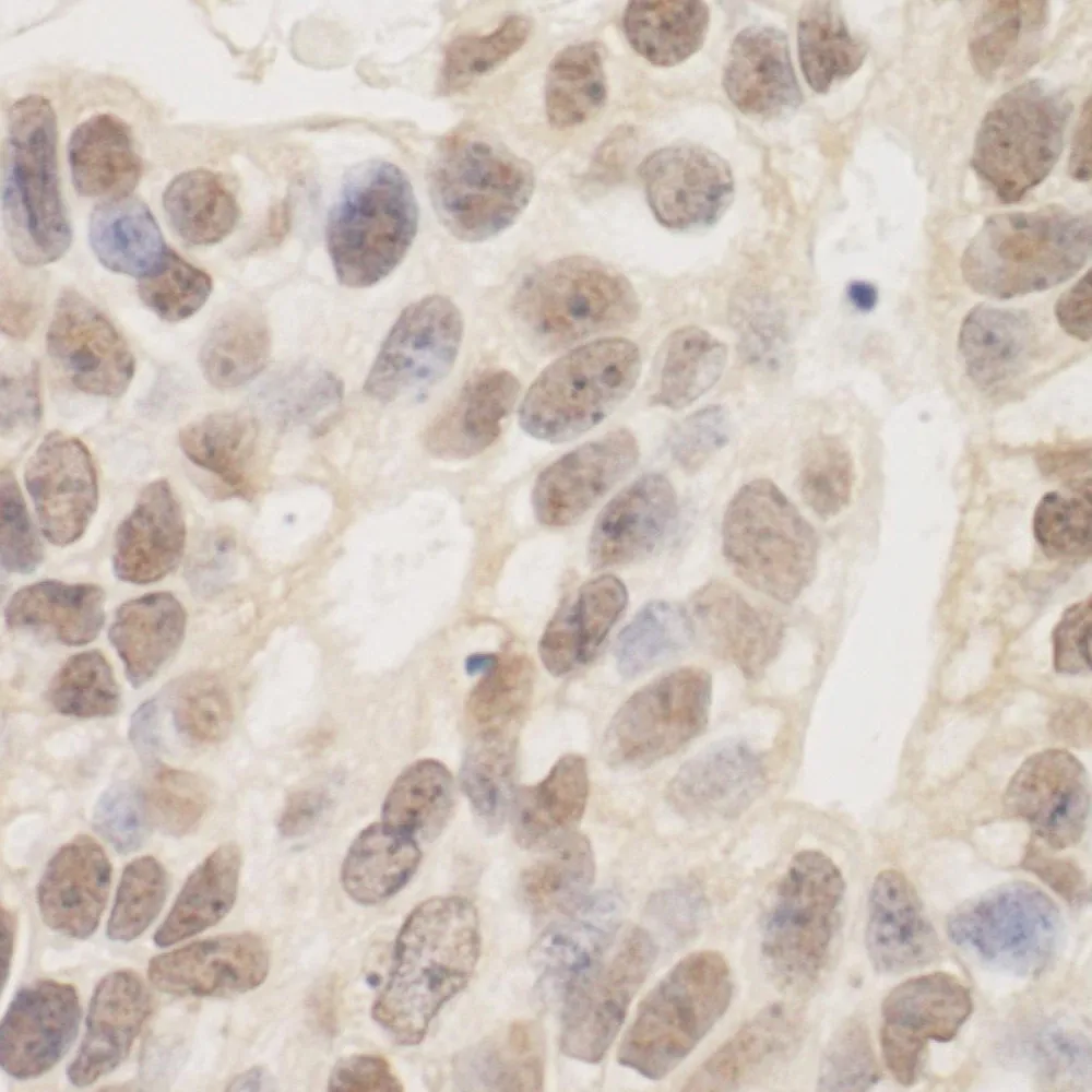Rabbit anti-SAP130 Antibody, Affinity Purified