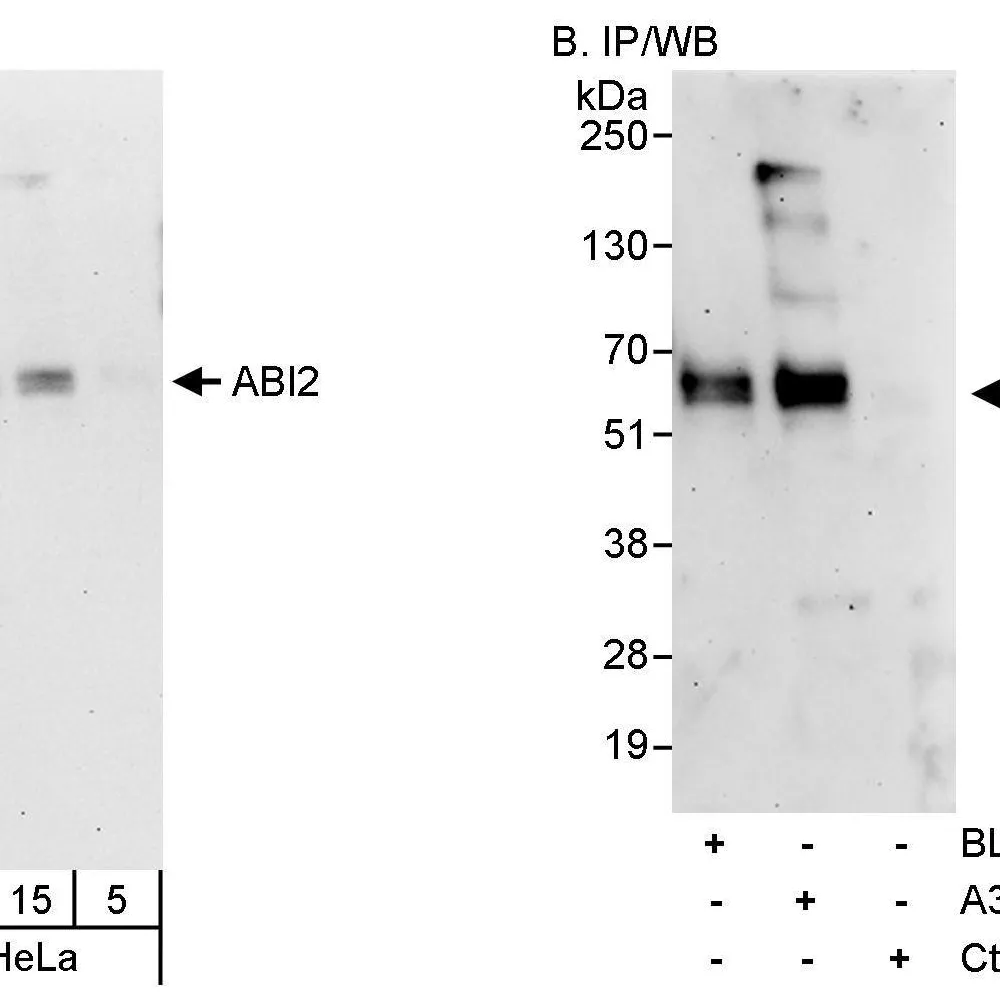 Rabbit anti-ABI2 Antibody, Affinity Purified