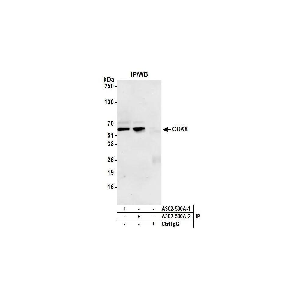 Rabbit anti-CDK8 Antibody, Affinity Purified