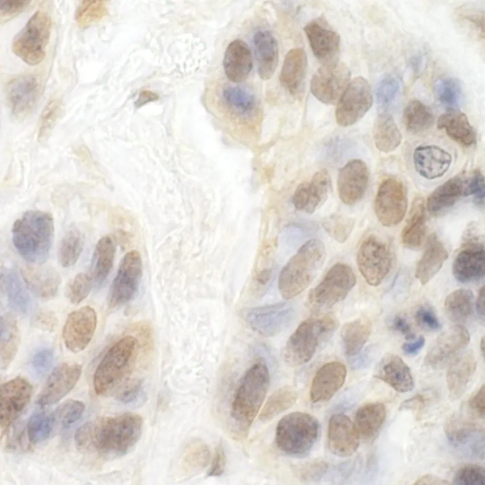 Rabbit anti-CDK8 Antibody, Affinity Purified