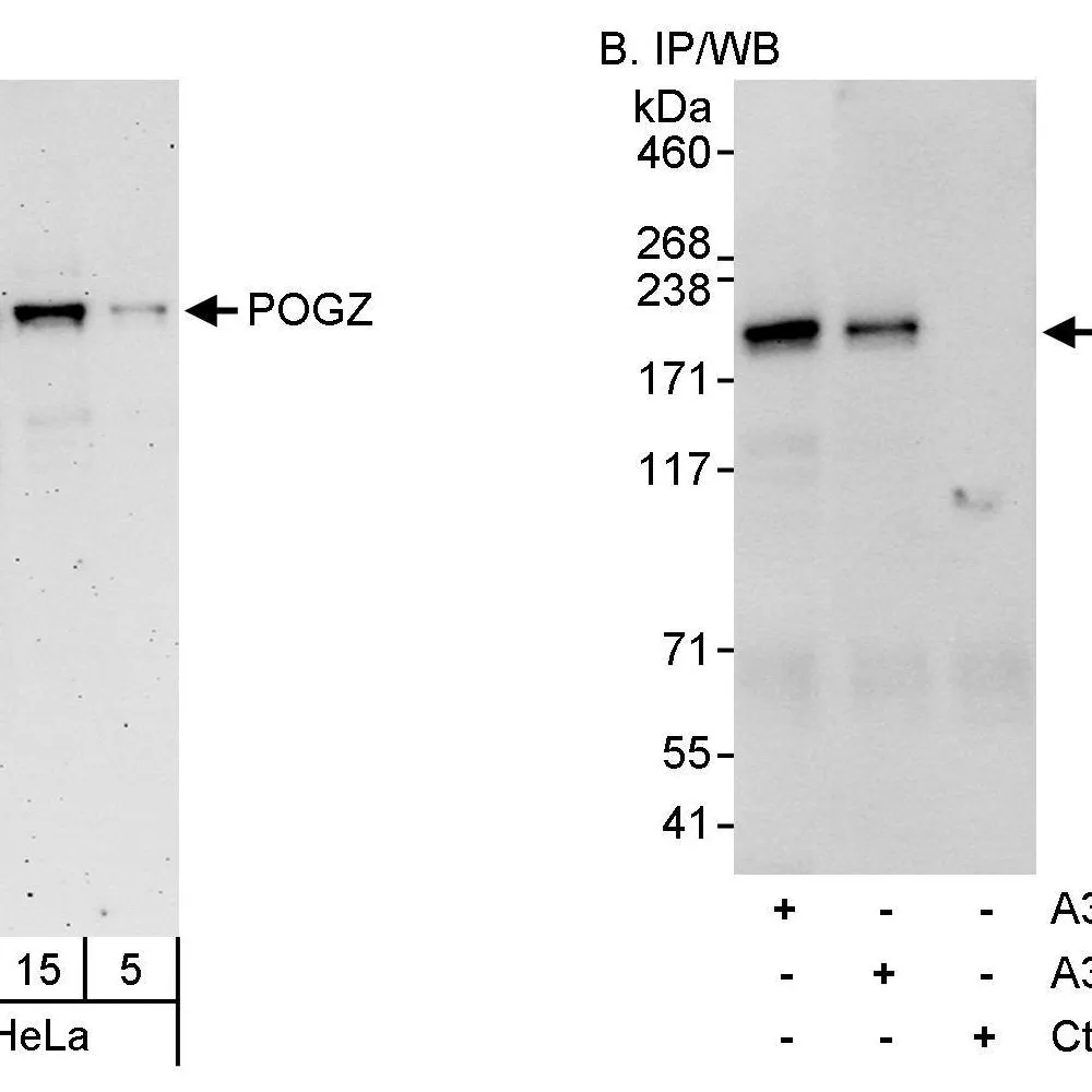 Rabbit anti-POGZ Antibody, Affinity Purified