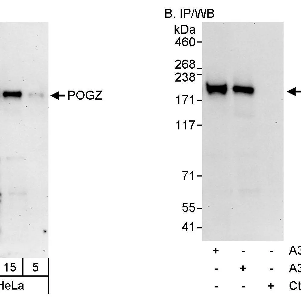 Rabbit anti-POGZ Antibody, Affinity Purified