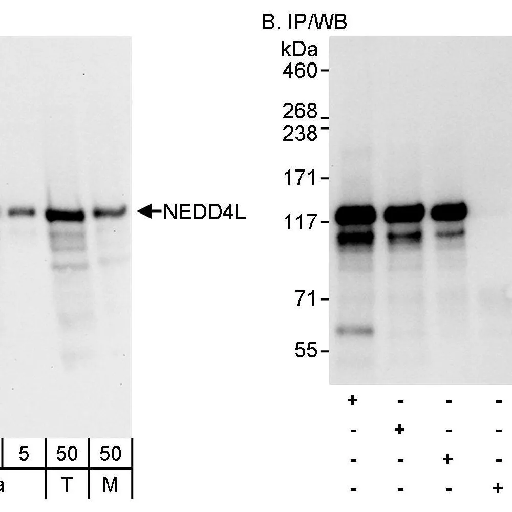 Rabbit anti-NEDD4L Antibody, Affinity Purified