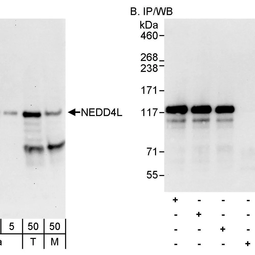 Rabbit anti-NEDD4L Antibody, Affinity Purified