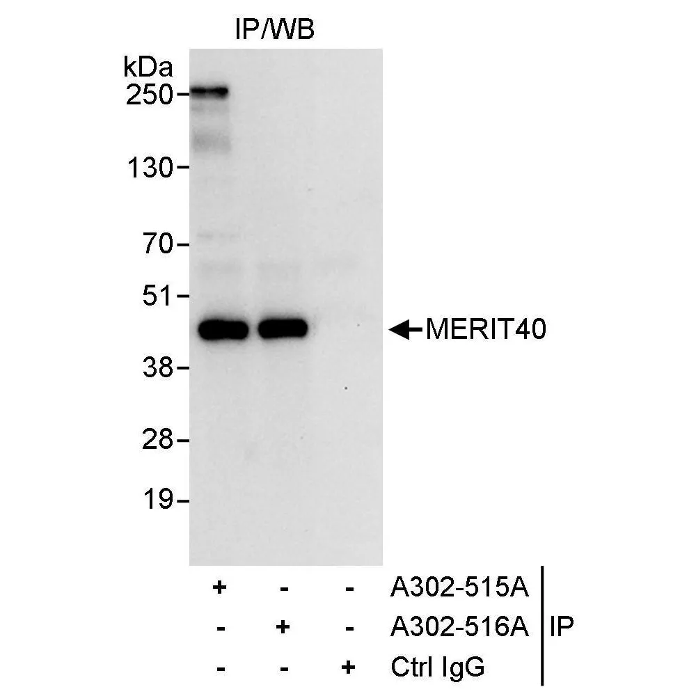 Rabbit anti-MERIT40 Antibody, Affinity Purified