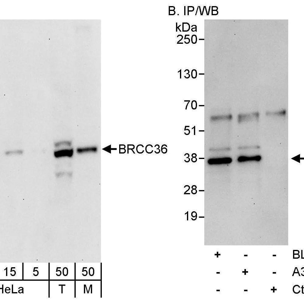 Rabbit anti-BRCC36 Antibody, Affinity Purified