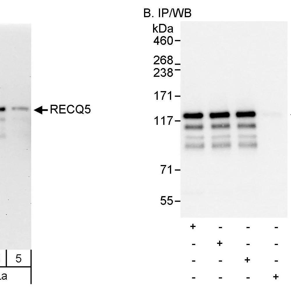Rabbit anti-RECQ5 Antibody, Affinity Purified