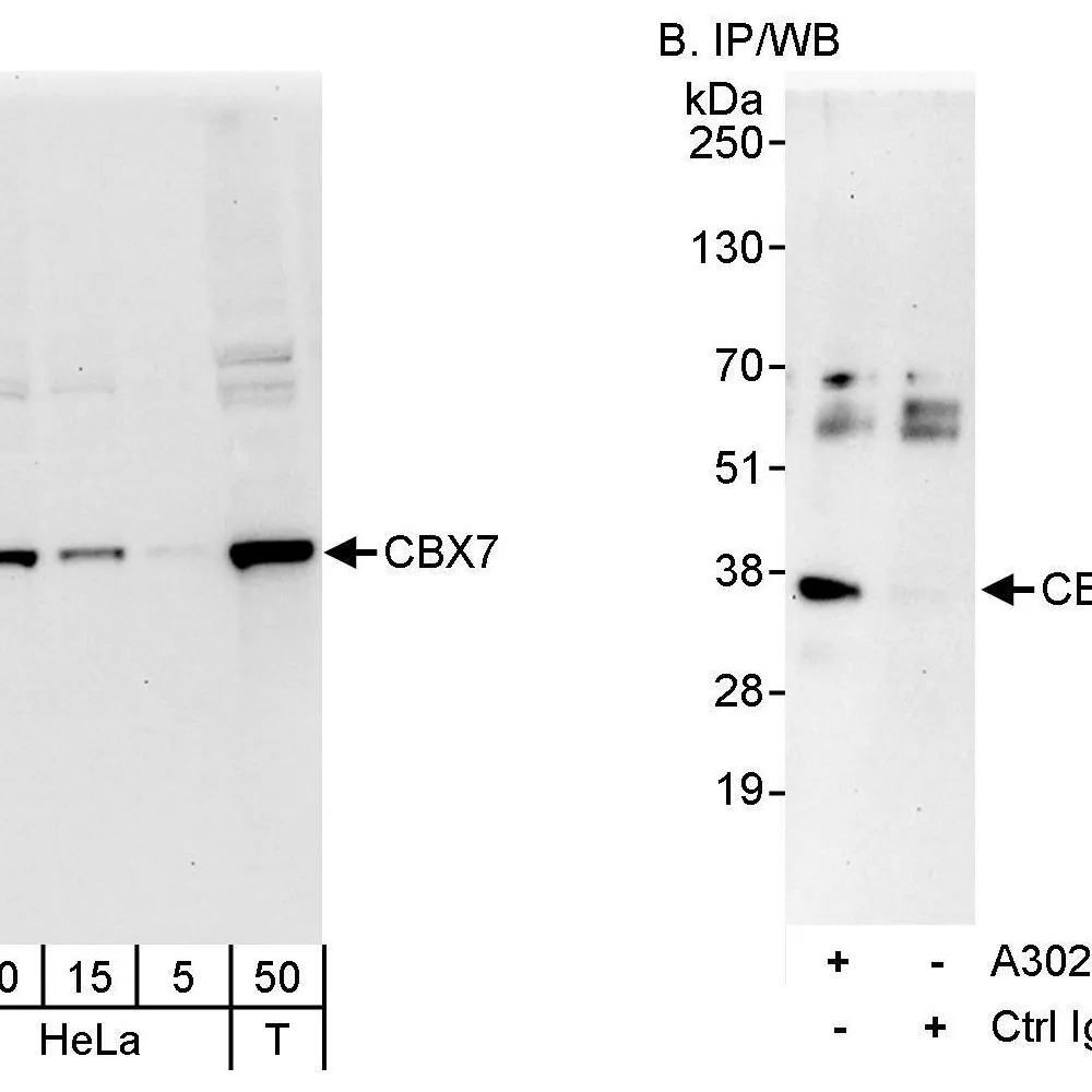 Rabbit anti-CBX7 Antibody, Affinity Purified