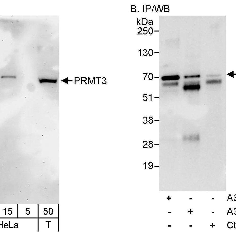 Rabbit anti-PRMT3 Antibody, Affinity Purified