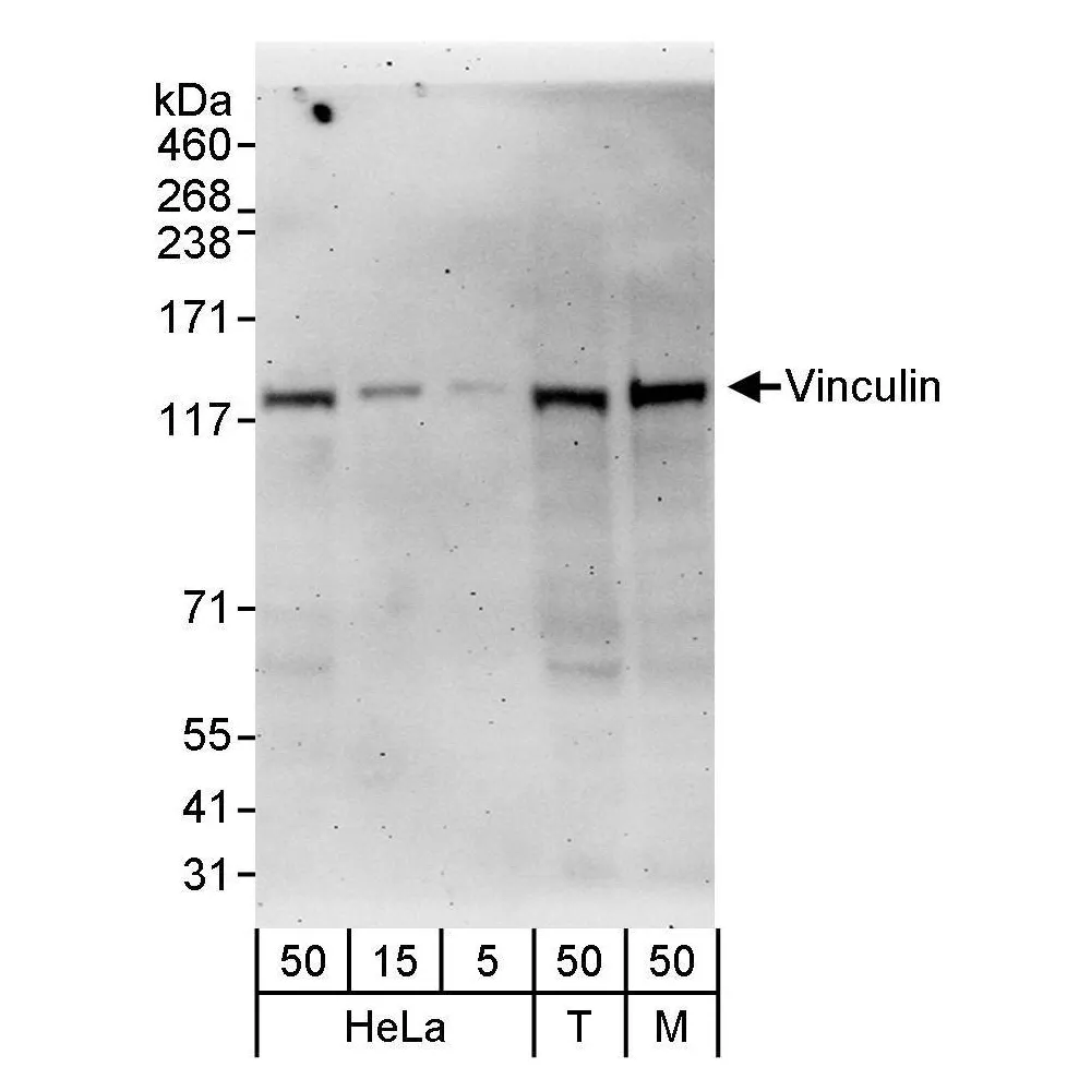 Rabbit anti-Vinculin Antibody, Affinity Purified