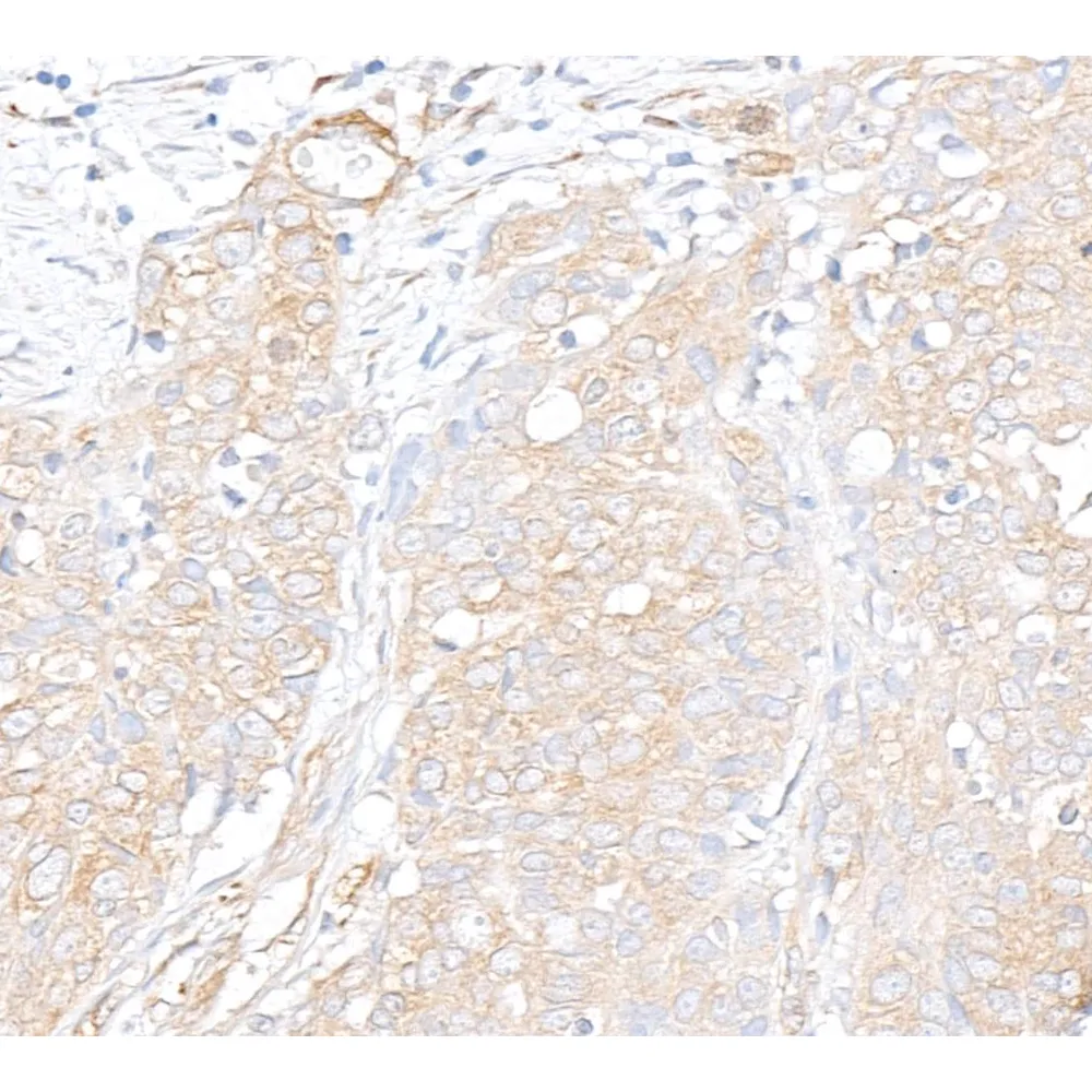 Rabbit anti-Vinculin Antibody, Affinity Purified